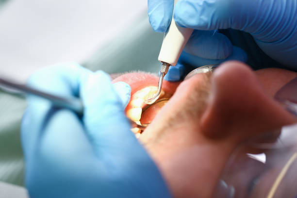 Best Orthodontic Emergency Dentist in New Tazewell, TN