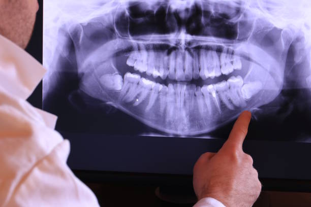 Best Urgent Dental Care for Toothache in New Tazewell, TN