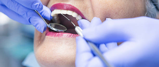 Best Emergency Dental Extractions in New Tazewell, TN